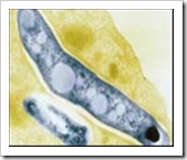 Is the UK prepared for TB threat?